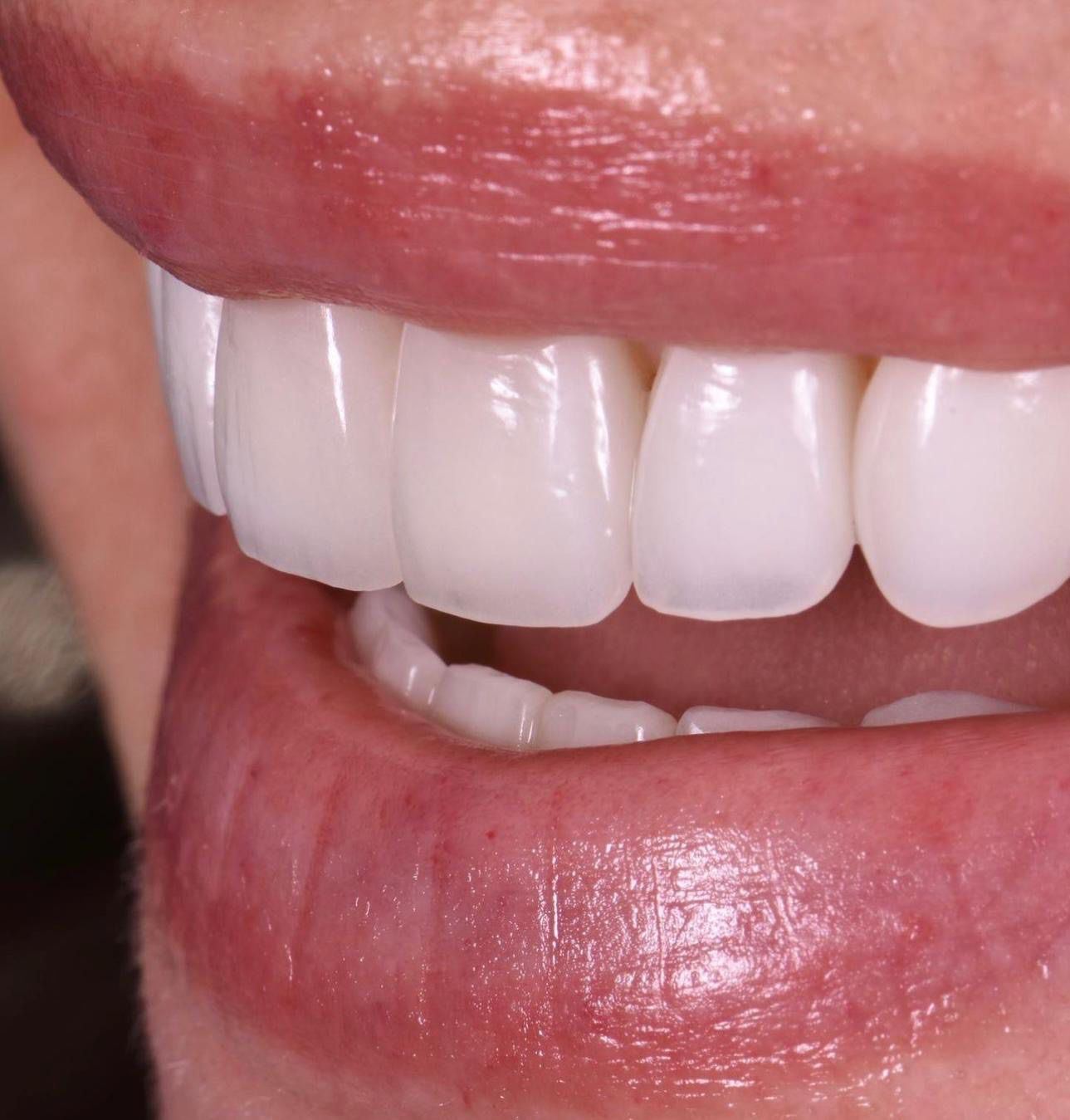 Cirugía periodontal: cuándo es necesaria y cómo se realiza