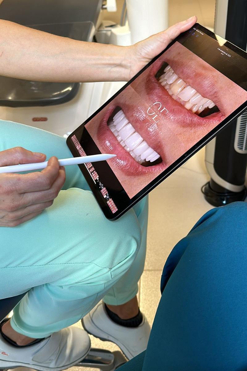 Extracciones dentales complejas: técnicas y recomendaciones